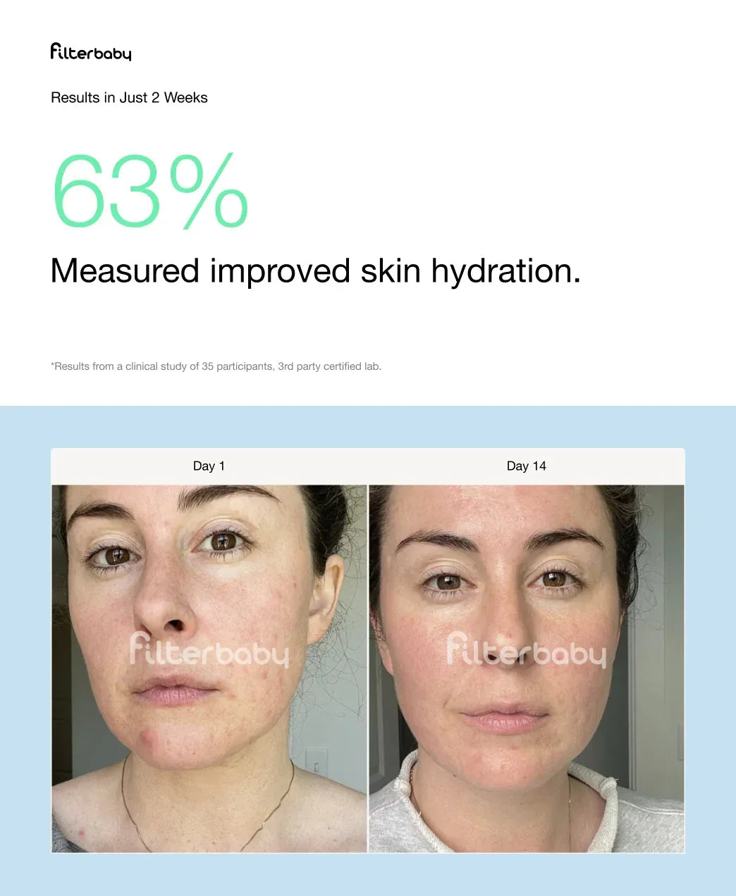 Filterbaby skincare hydration results, before and after 2 weeks, improved skin glow and texture