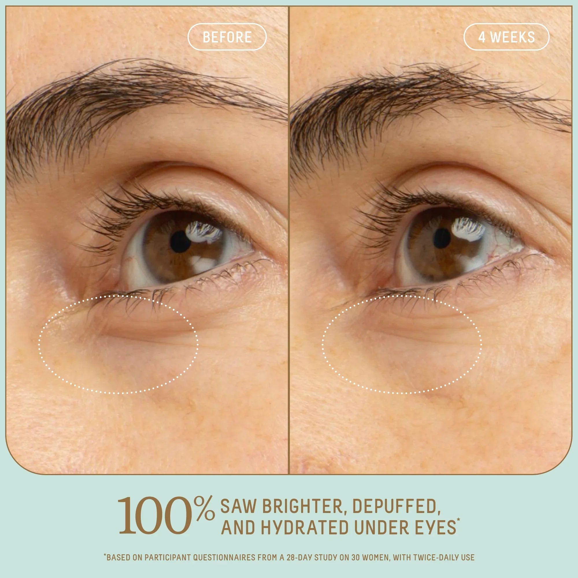 Squalane + 5% Niacinamide Brightening Eye Serum Image 3