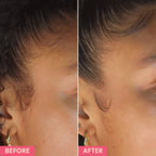 Before and after close-up of woman's hairline smoothing, showcasing beauty product results