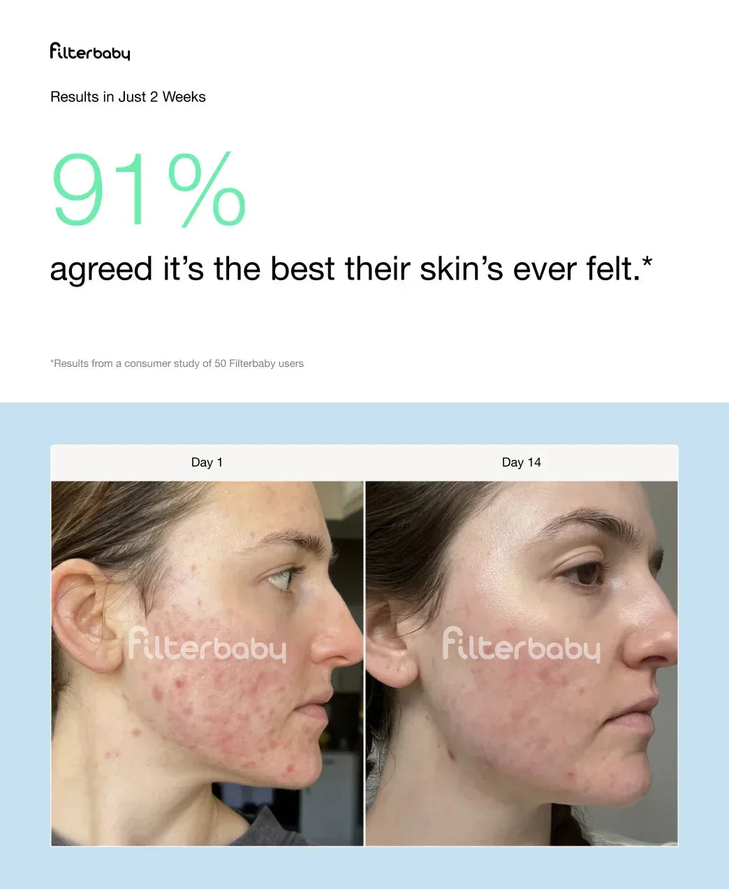Filterbaby skincare results before and after 2 weeks, showing smoother, clearer complexion.