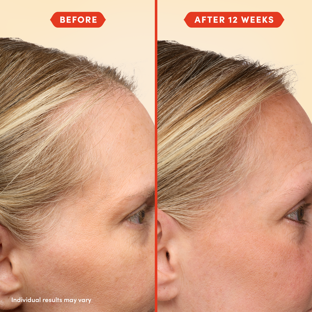 Fable & Mane HoliRoots Hair Oil - fableandmane - Hair Treatment - Original: 55ml / 1.8 FL oz - Wylde Grey