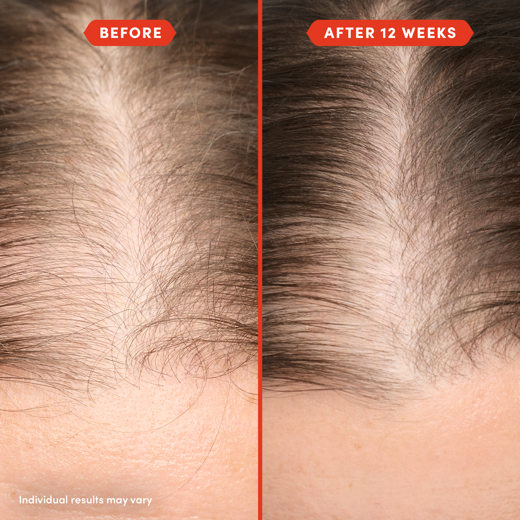 Fable & Mane HoliRoots Hair Oil - fableandmane - Hair Treatment - Original: 55ml / 1.8 FL oz - Wylde Grey