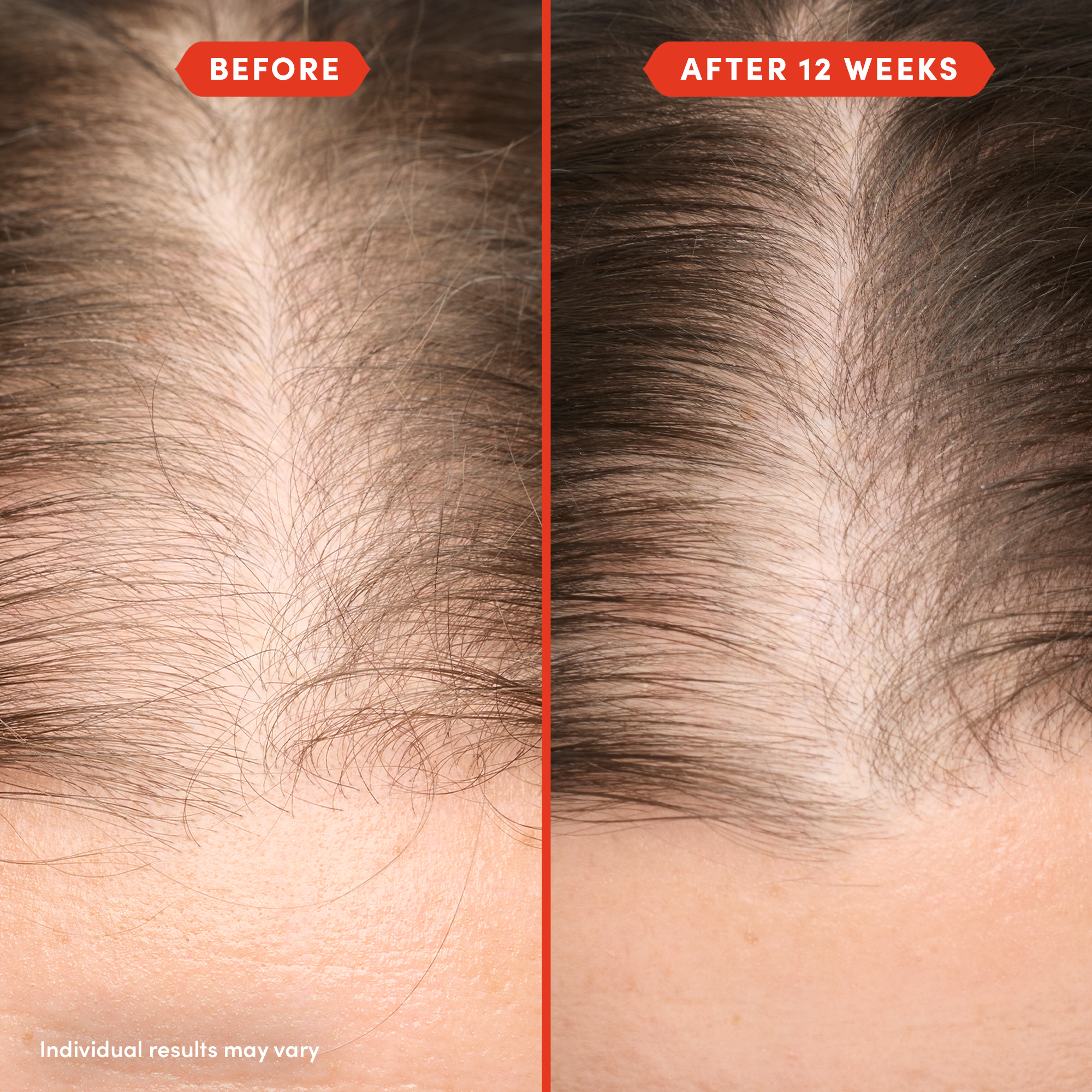 Fable & Mane HoliRoots Hair Oil - fableandmane - Hair Treatment - Original: 55ml / 1.8 FL oz - Wylde Grey