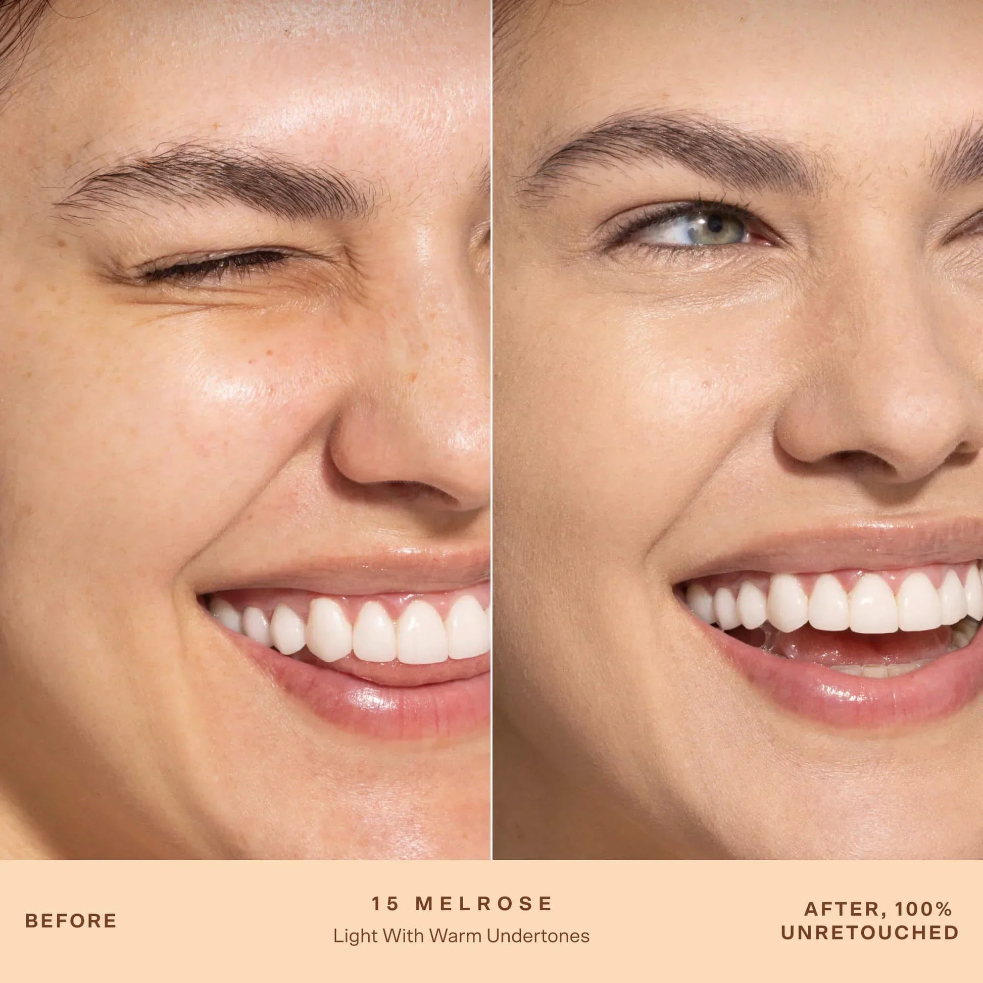 A person's face before and after applying SunnyDays™ Tinted SPF 30 in the shade 15 Melrose, revealing sheer, buildable coverage that visibly evens skin tone and softens discoloration while maintaining a natural, skin-like finish. [15 Melrose]