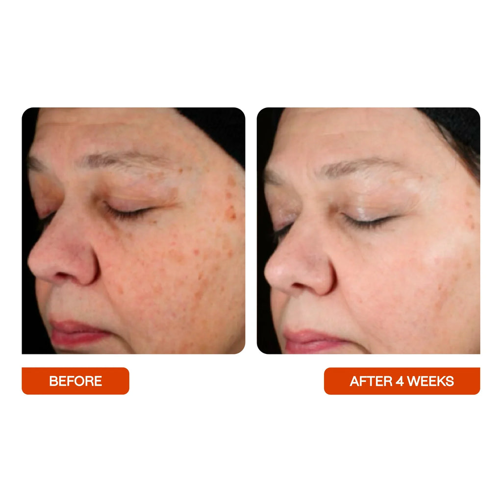 Side-by-side before and after of a woman's face, showing smoother, brighter skin in 4 weeks.