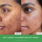 Side-by-side before and after of a woman with visibly clearer, smoother skin texture, Wylde Grey skincare results