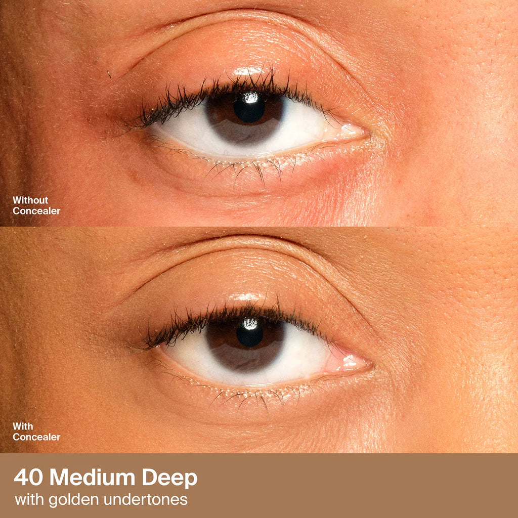 40 Medium Deep Golden