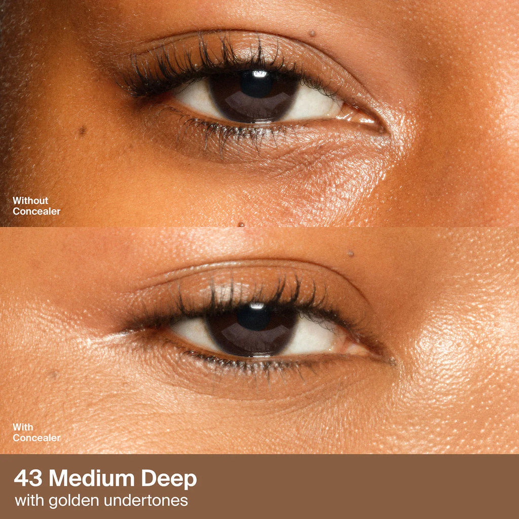 43 Medium Deep Golden