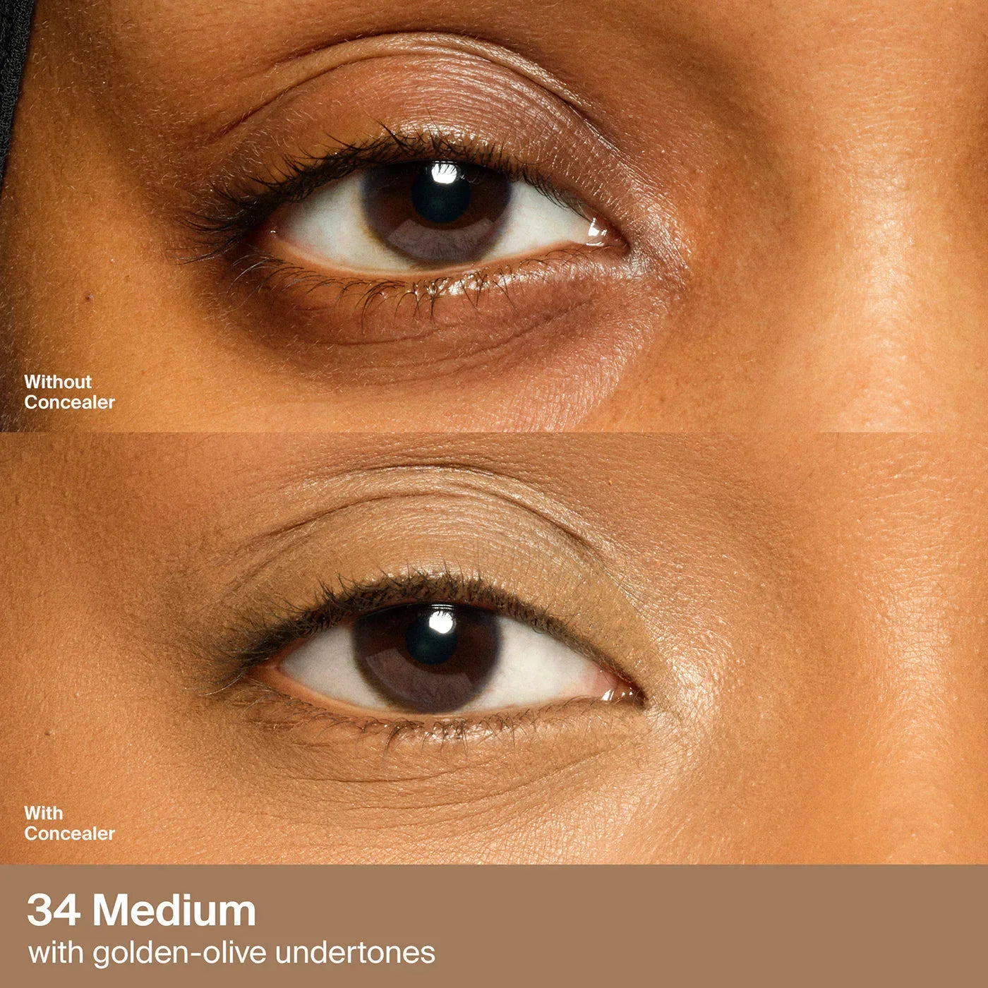 34 Medium Golden
