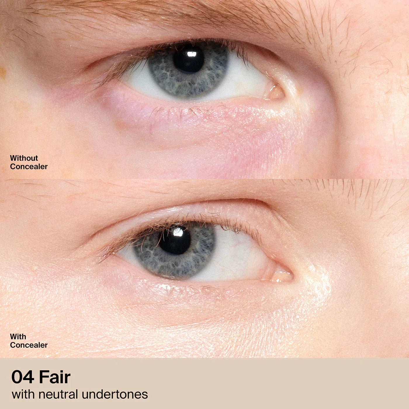 04 Fair Neutral