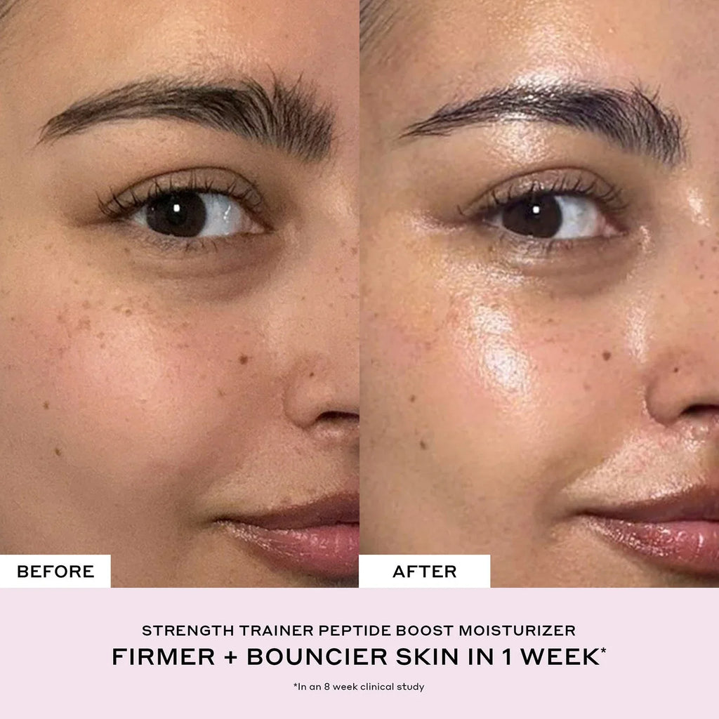Before and after close-up of a woman's face showing smoother, firmer, dewy skin texture.