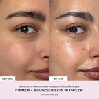 Before and after close-up of a woman's face showing smoother, firmer, dewy skin texture.