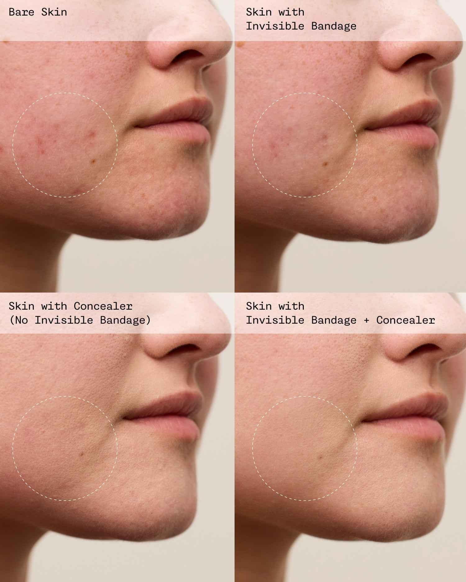 Violette FR Invisible Bandage