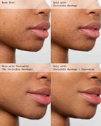 Violette FR Invisible Bandage