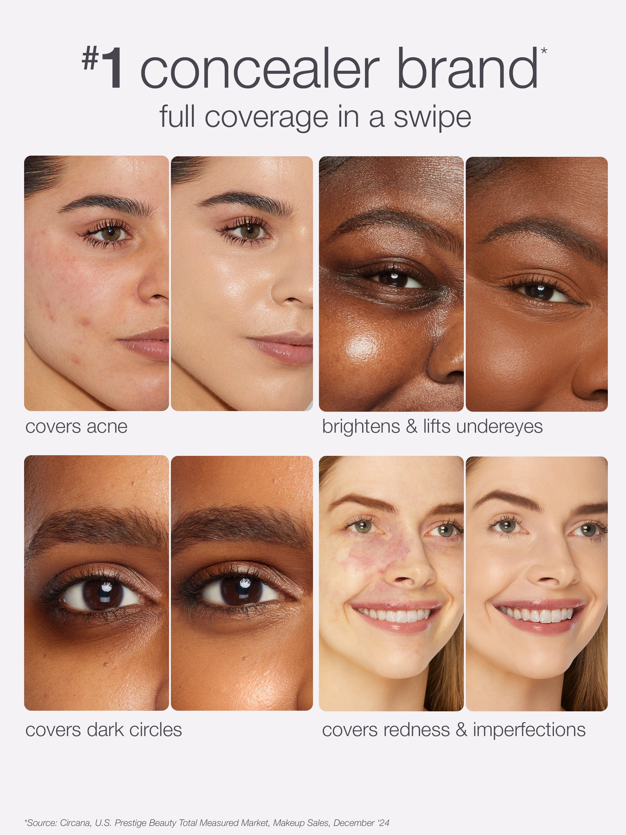 Concealer advertisement showing its effectiveness on various skin imperfections with a white background.