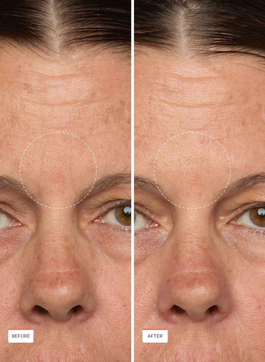 MiniProtein Exosome Bioactive Ampoule Peach and Lily