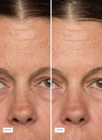 MiniProtein Exosome Bioactive Ampoule Peach and Lily