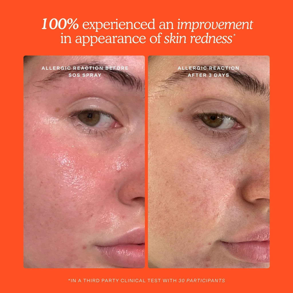 Tower 28 SOS 3-Step Skincare Set