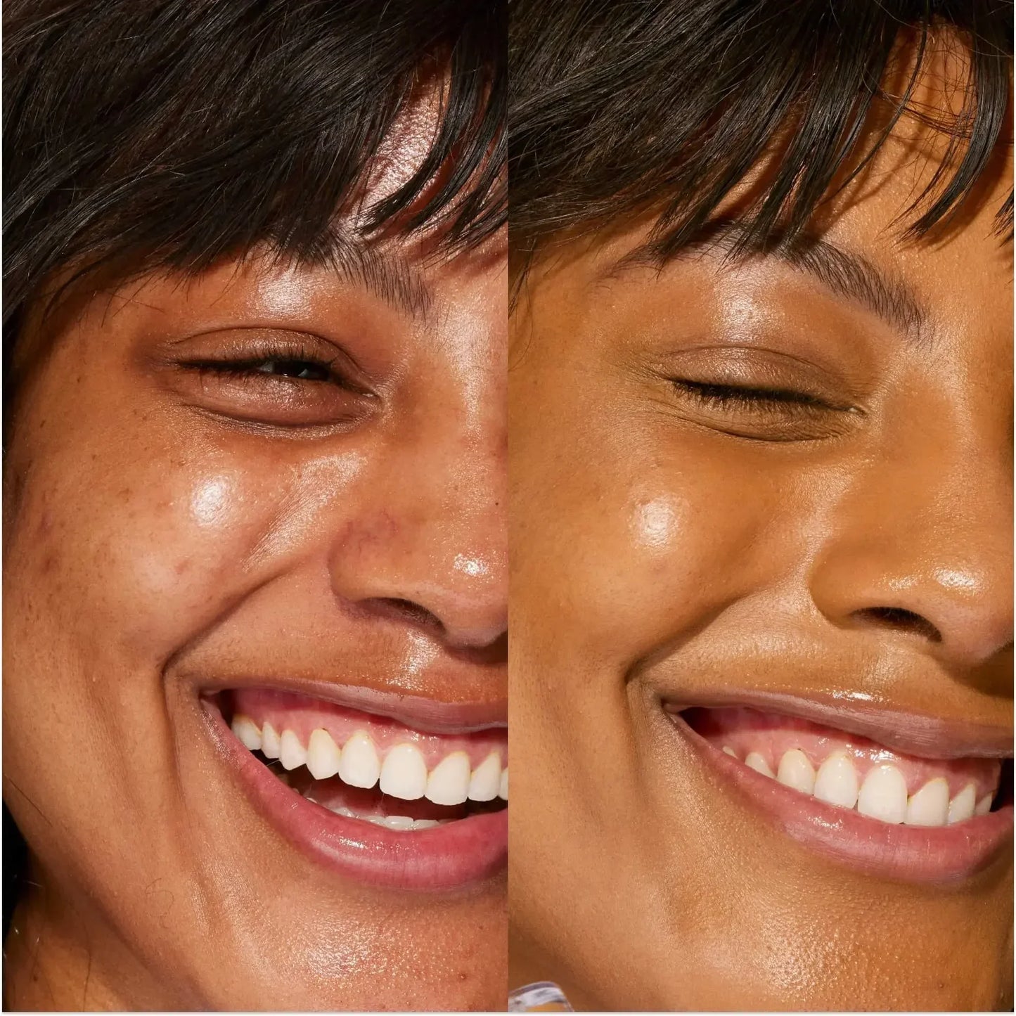 Close-up before and after of smiling woman with dewy, smooth skin and radiant concealer finish