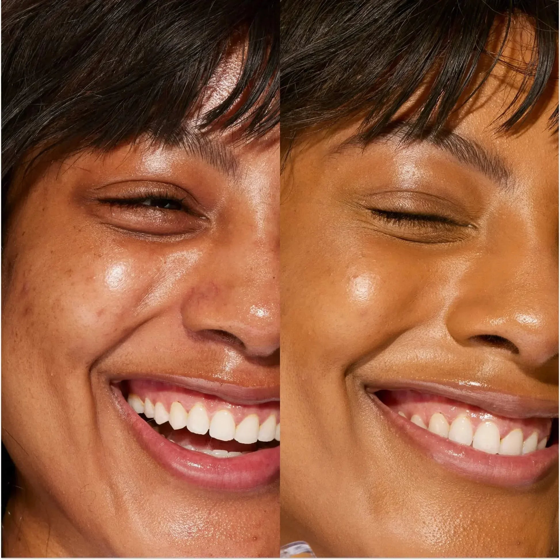 Close-up before and after of smiling woman with dewy, smooth skin and radiant concealer finish