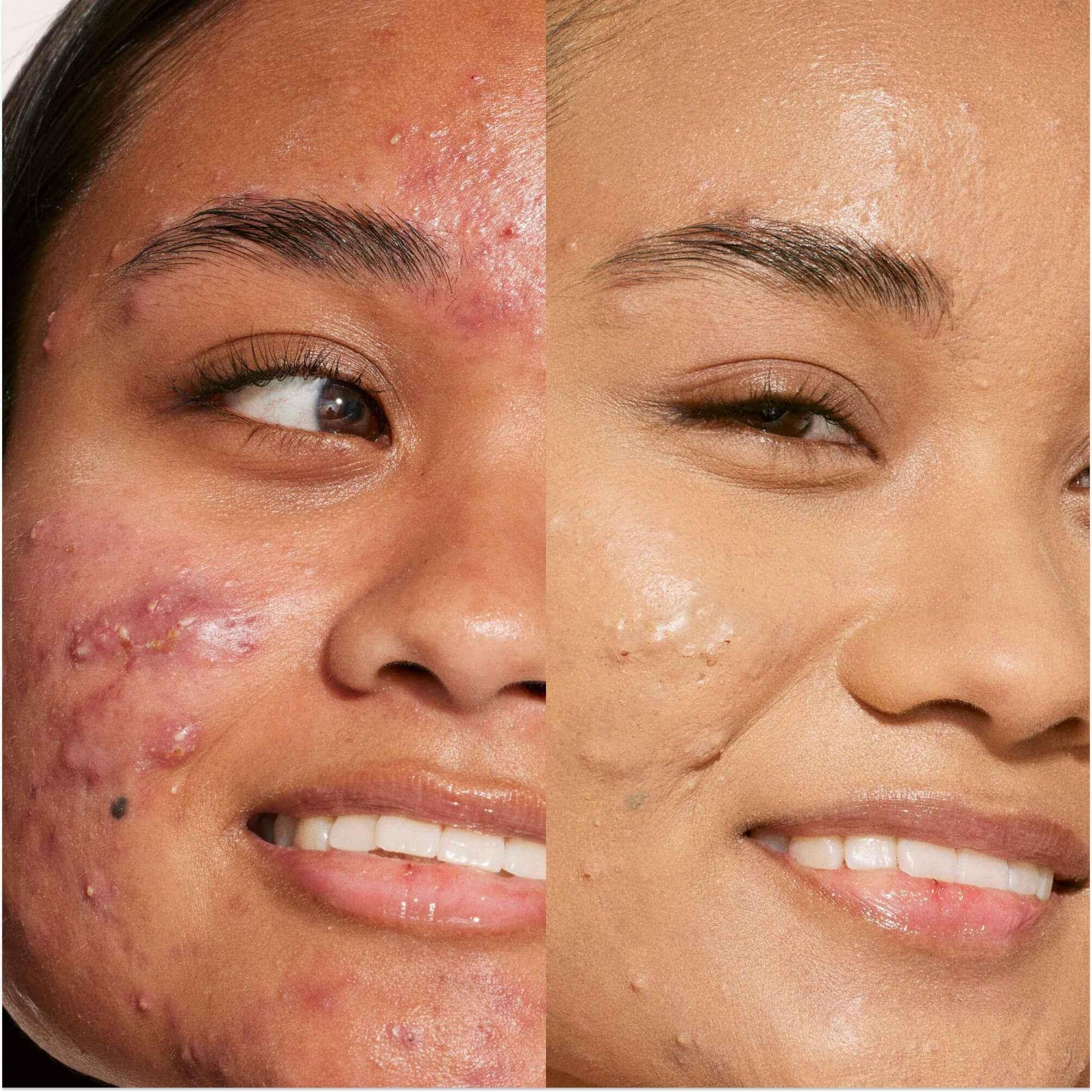 Close-up before and after of woman's face showing smooth, radiant skin with creamy concealer coverage.