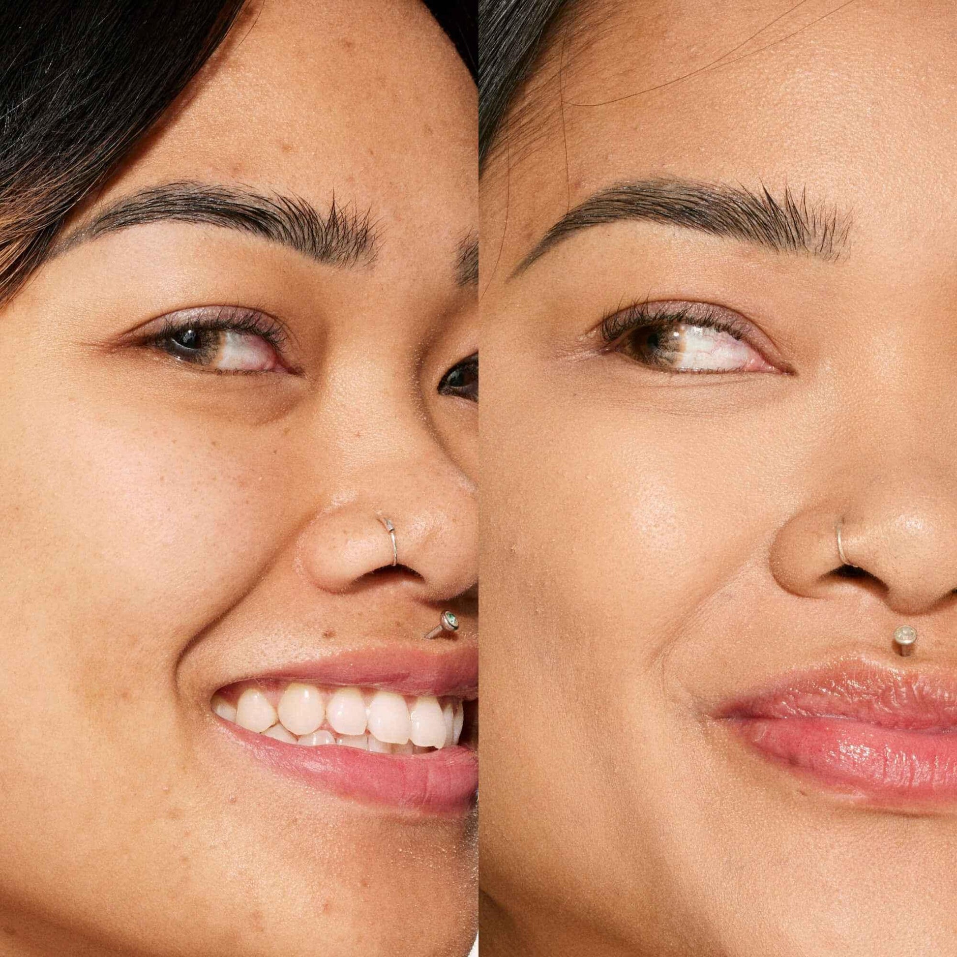 Close-up before and after of a woman with smooth, even, dewy skin and natural makeup.