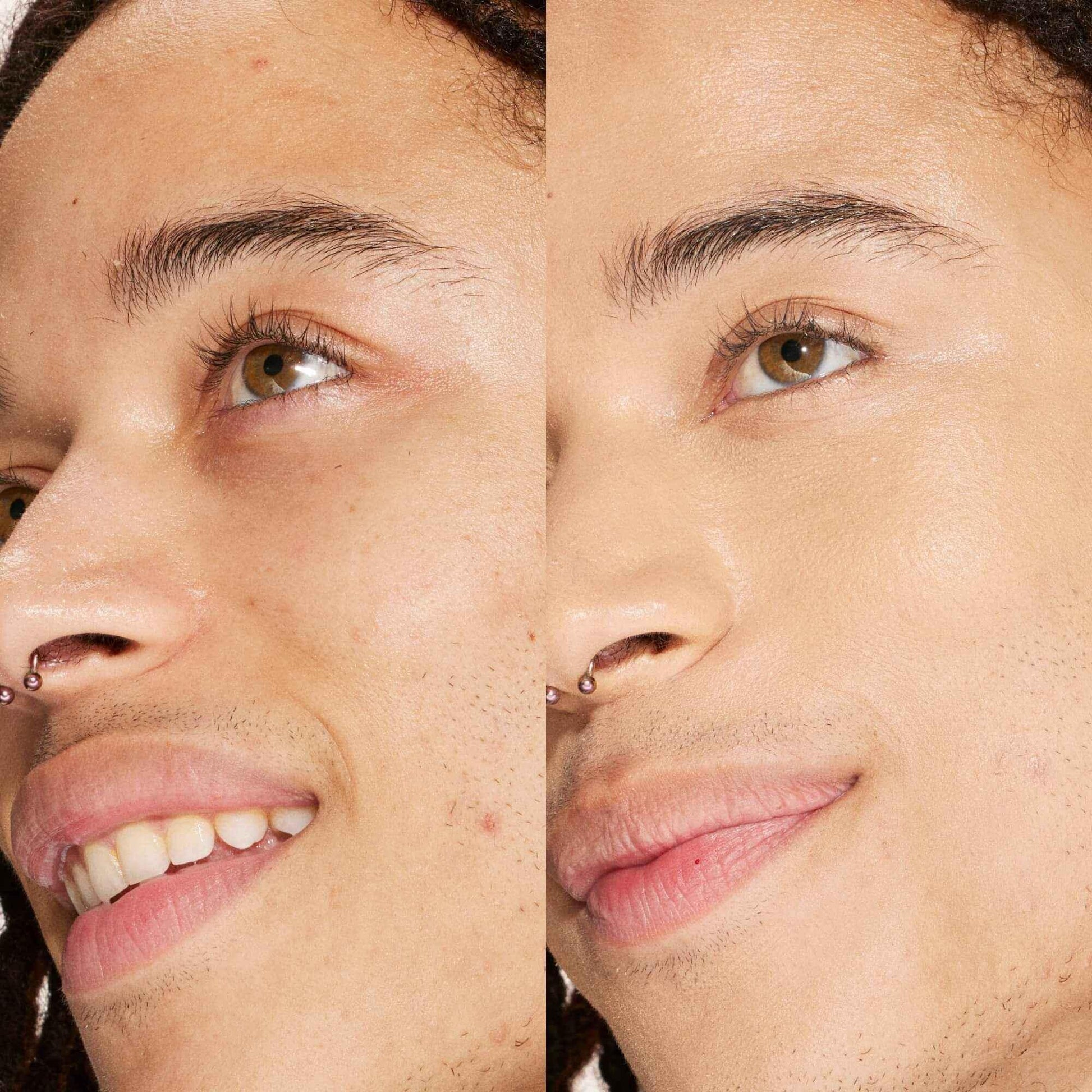 Close-up before and after of dewy finish concealer giving smooth, natural skin texture
