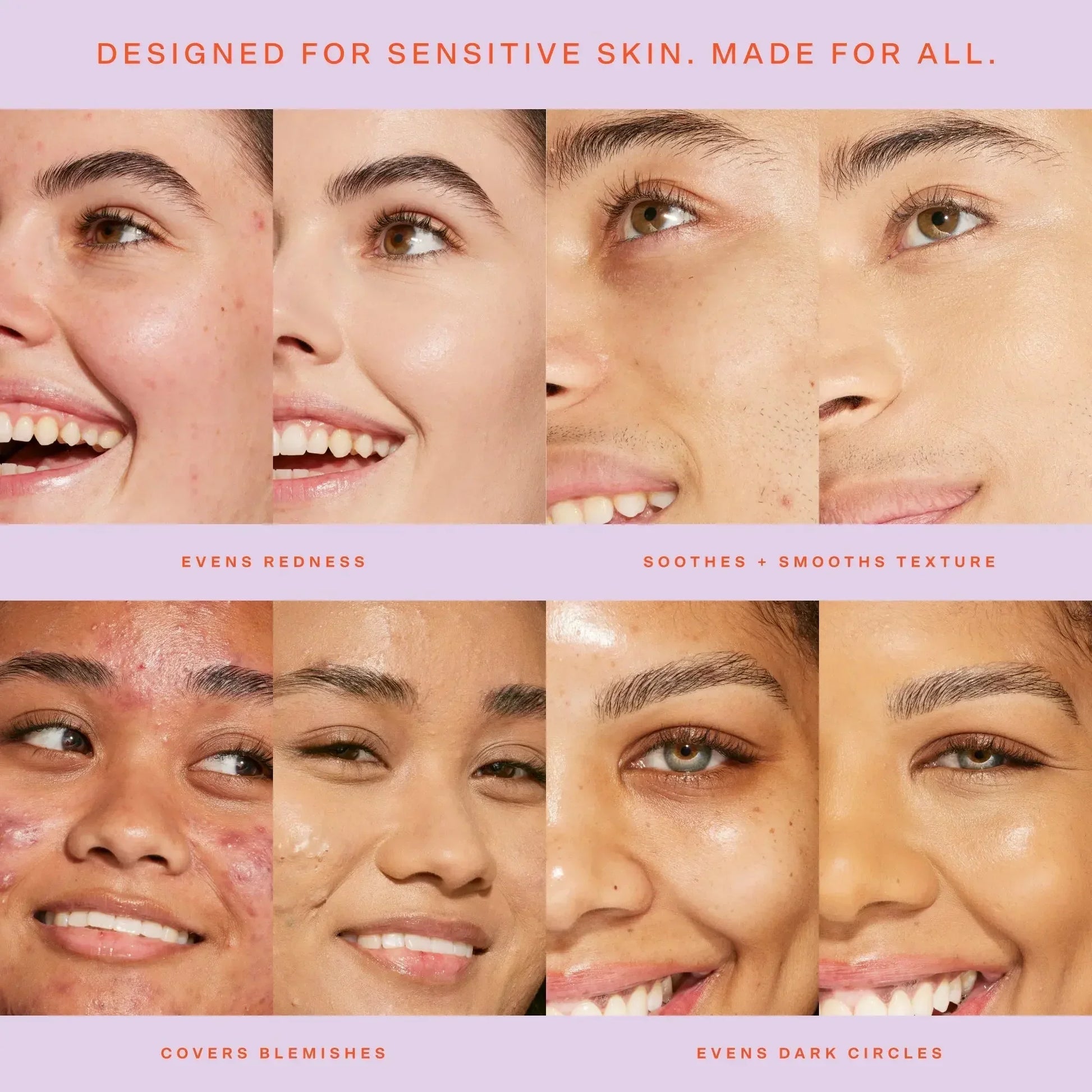 Before and after close-ups of diverse faces showing concealer’s dewy finish covering redness, blemishes, and dark circles.