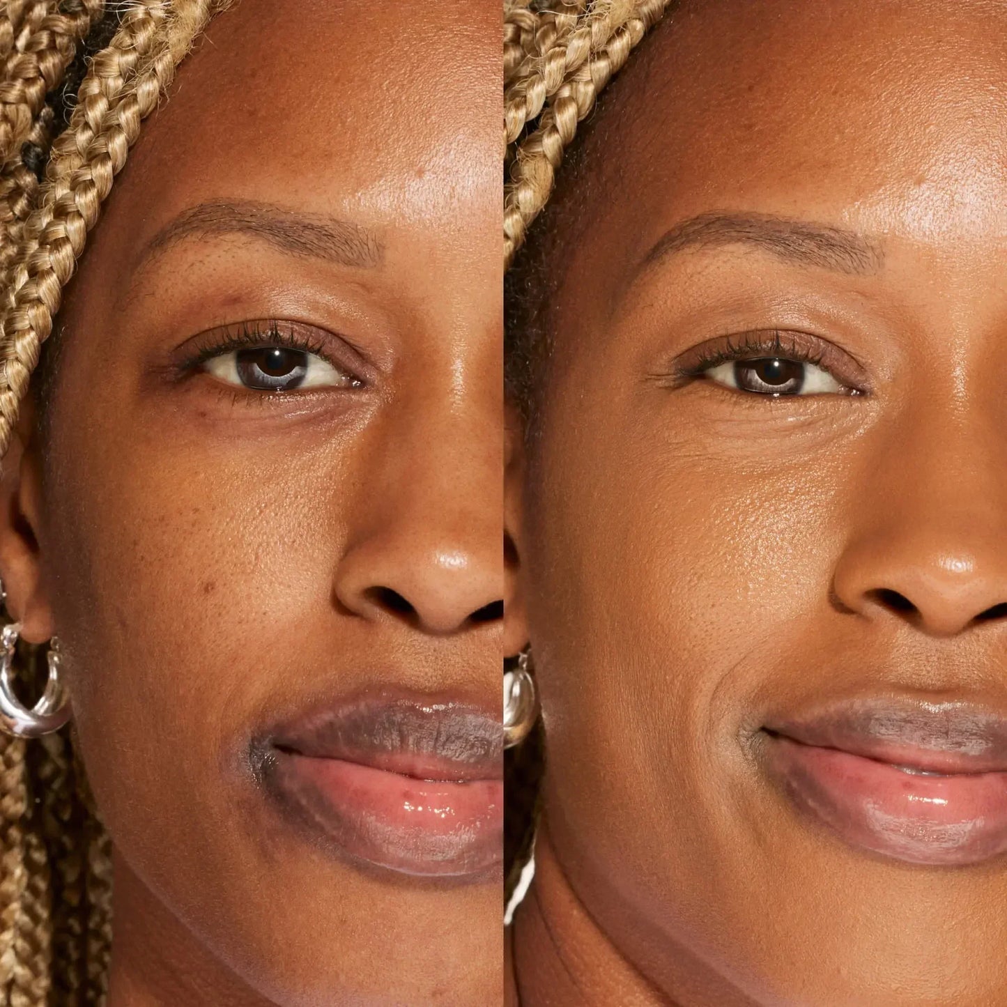 Side-by-side before and after of woman with medium-deep skin, showing flawless, dewy finish concealer coverage.