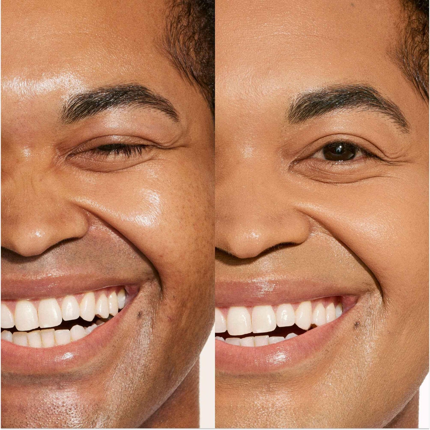 Close-up split view of a smiling face showing natural skin on the left and smooth, even-toned, dewy finish concealer coverage on the right.