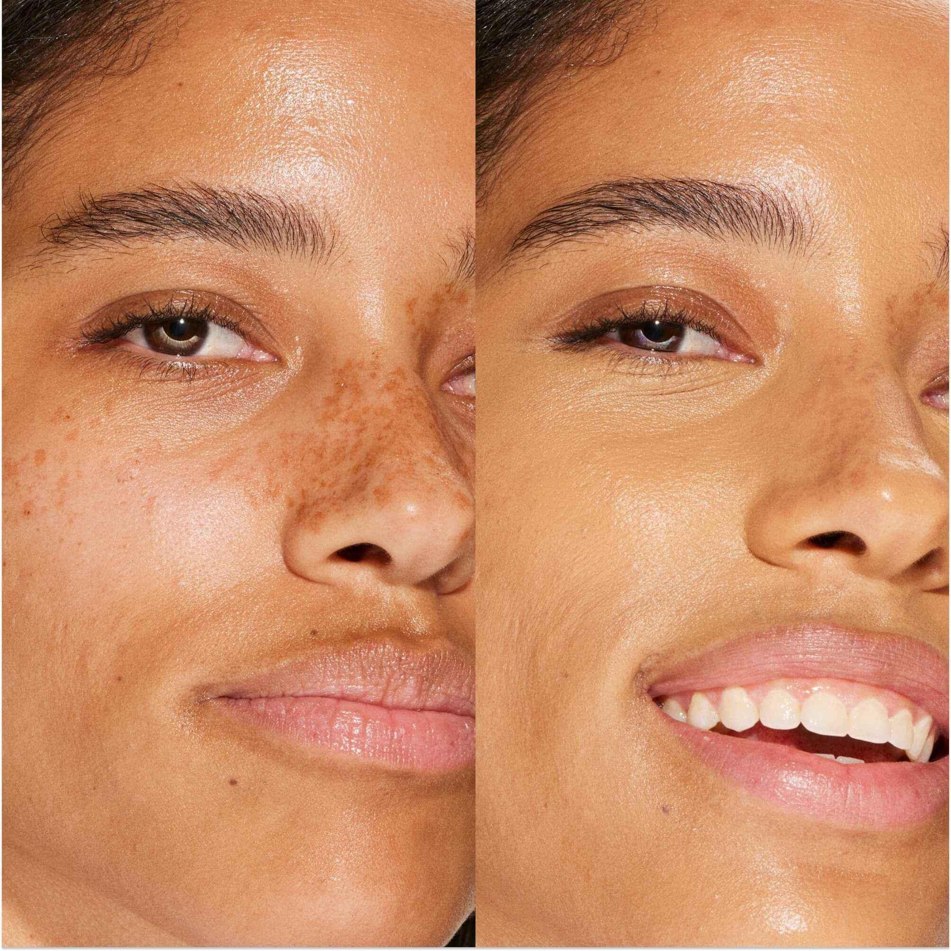 Close-up of model's face before and after creamy concealer, showing a dewy, flawless finish.