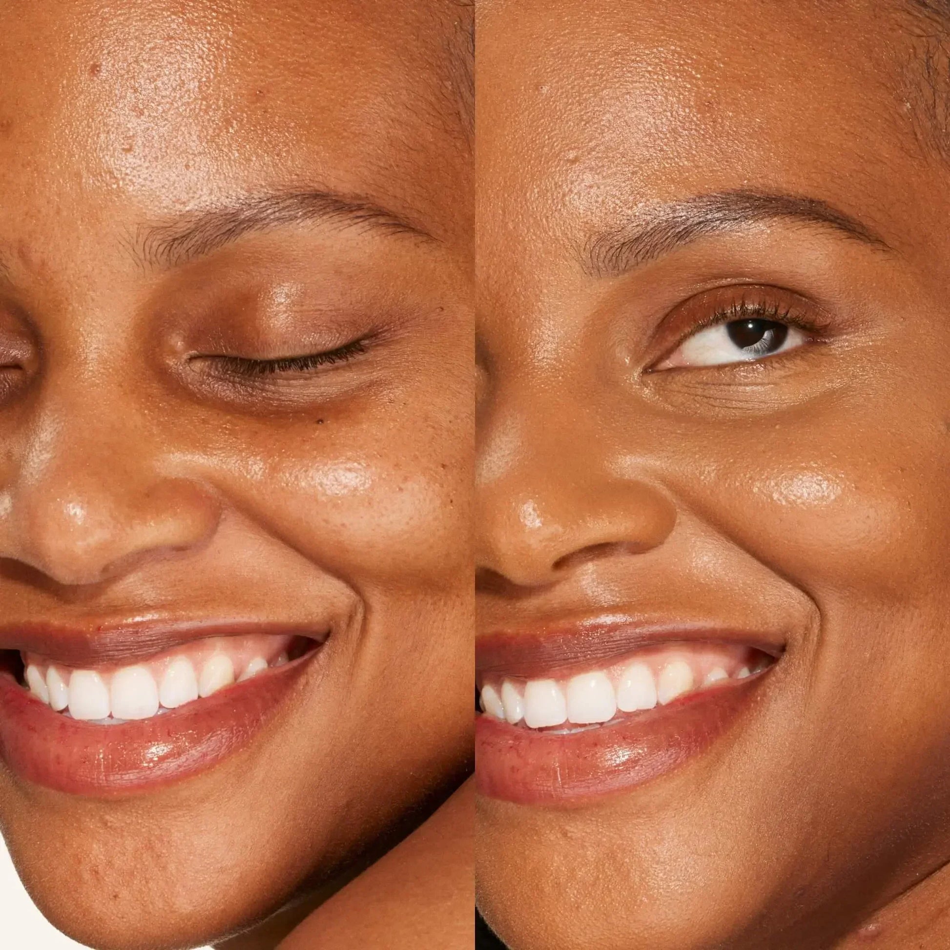 Before and after close-up of smooth, radiant skin with natural dewy finish, concealer applied.