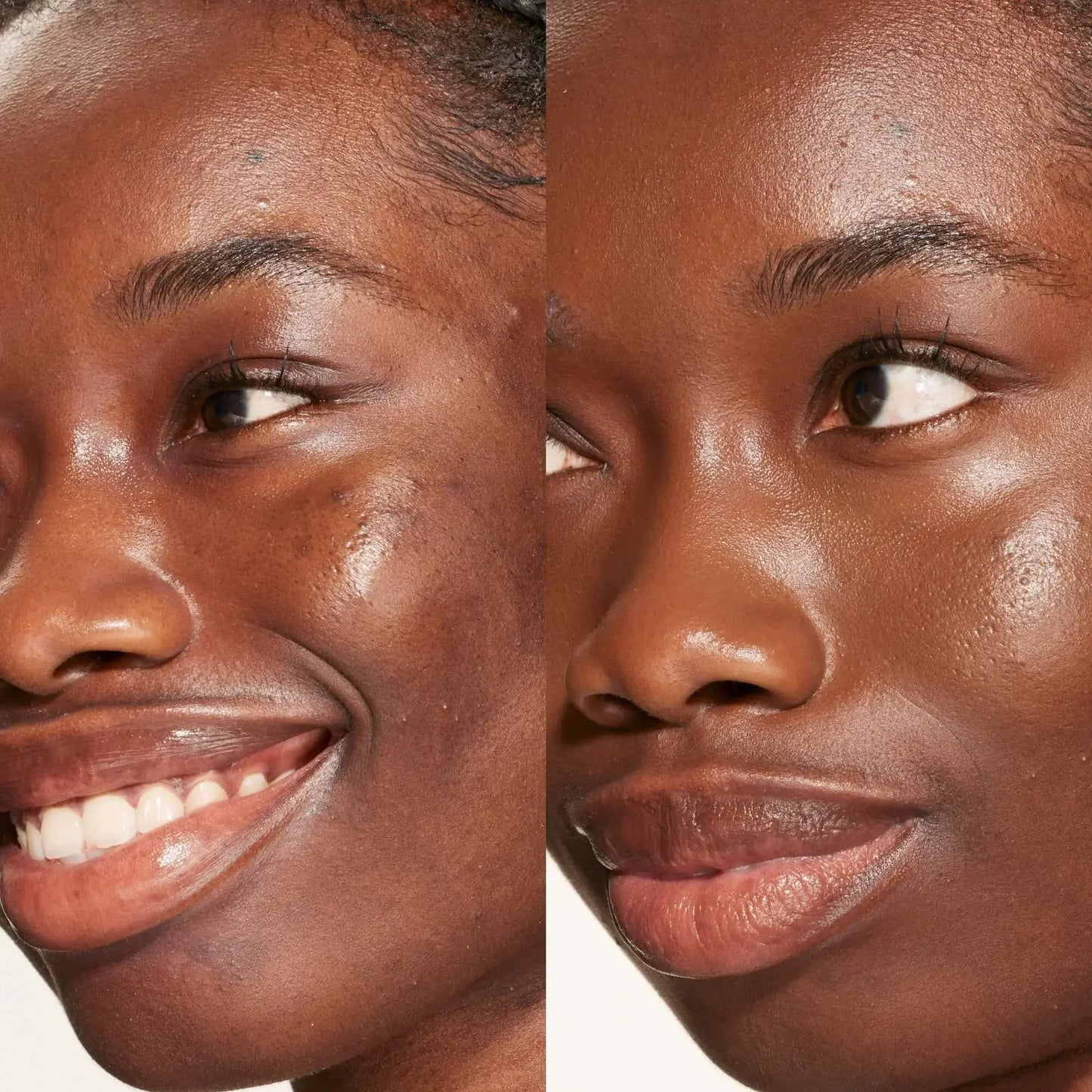 Close-up of deep skin tone before and after serum concealer, showing smooth, radiant, dewy finish