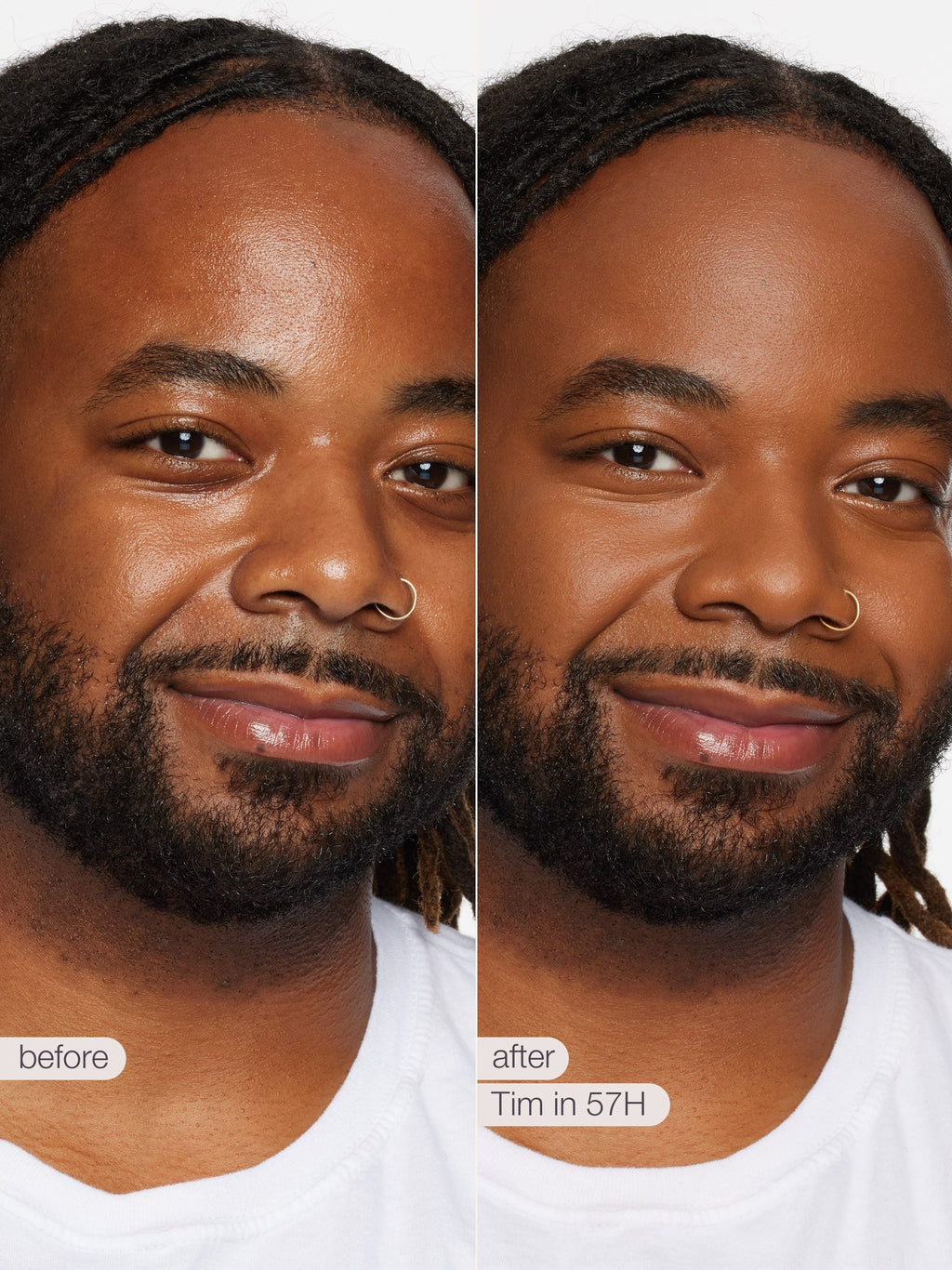 Before and after comparison of a man with dreads, showing a visible change in skin texture and color over time.