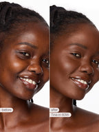 Before and after comparison of a woman's face with visible skin texture improvement.