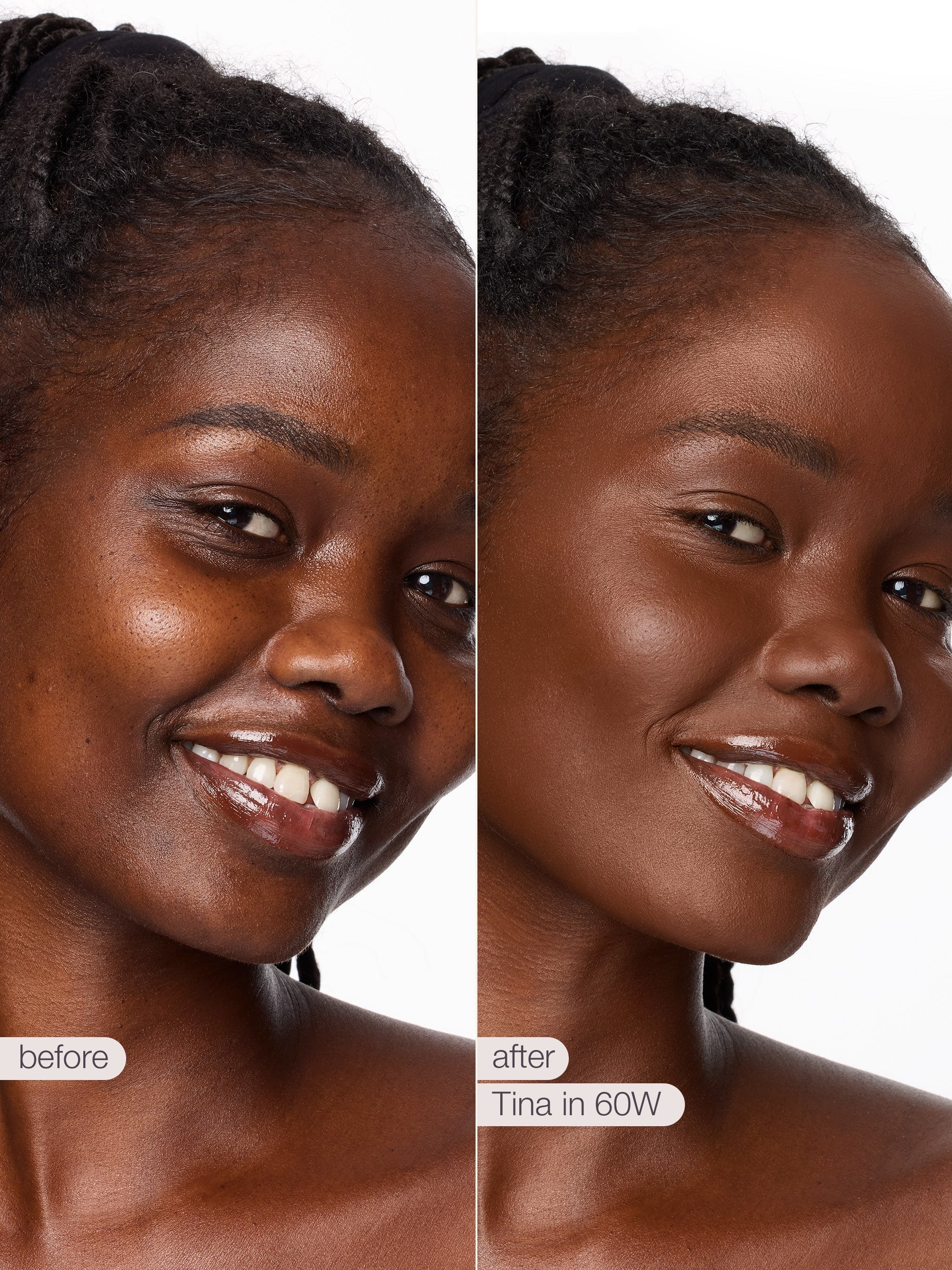 Before and after comparison of a woman's face with visible skin texture improvement.