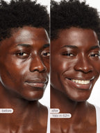 Before and after comparison of a person's face with text indicating 'before' and 'after' and product name.