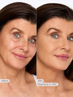 Before and after comparison of a woman's face with visible skin texture differences, labeled 'before' and 'after' with 'Stephanie in 35N'.