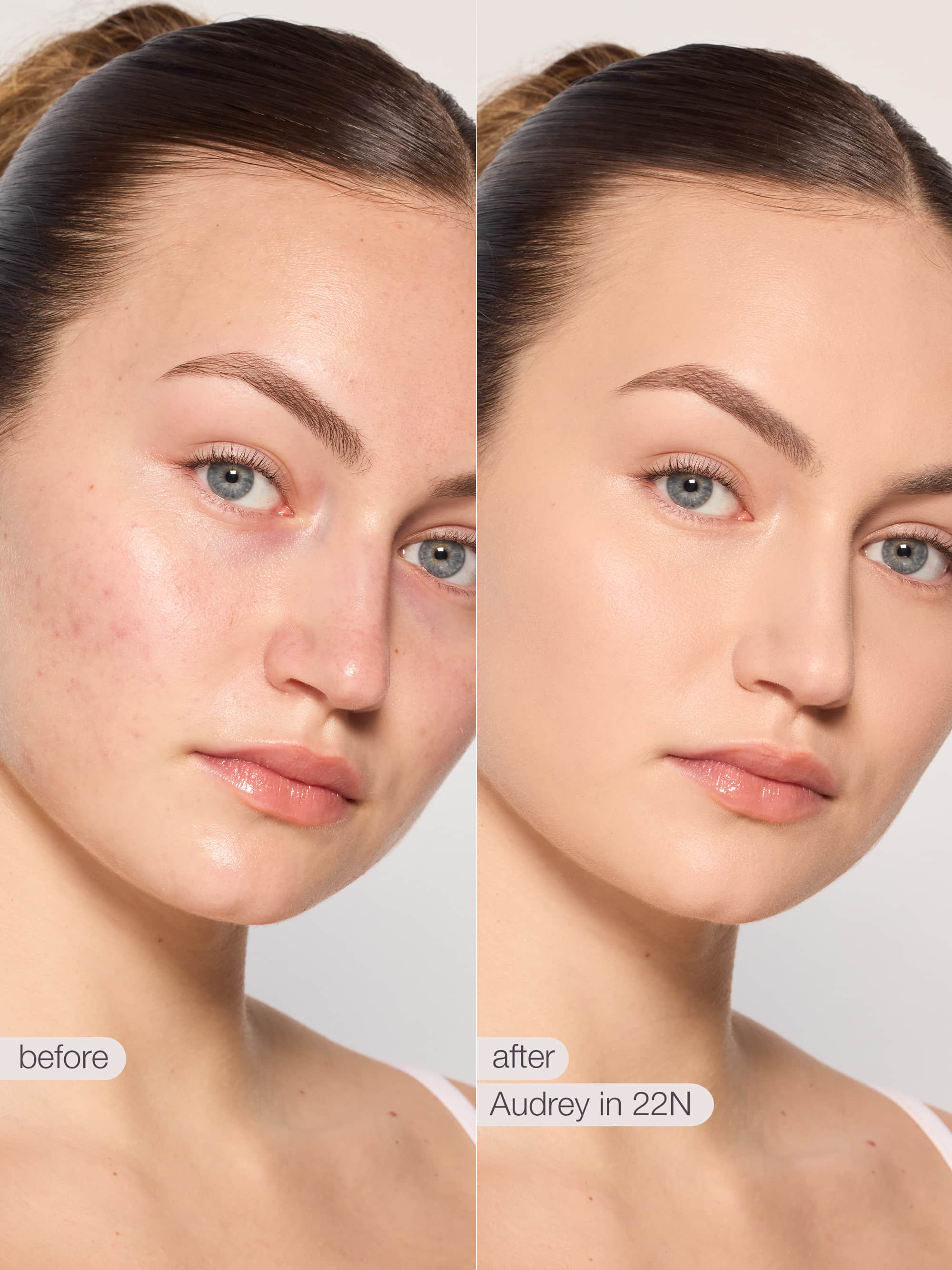 Before and after comparison of a woman's face with skin treatment labeled 'Nellie in 22N'.