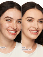 Before and after comparison of a woman's face with visible skin improvement using a product named 'Sophia in 20S'.