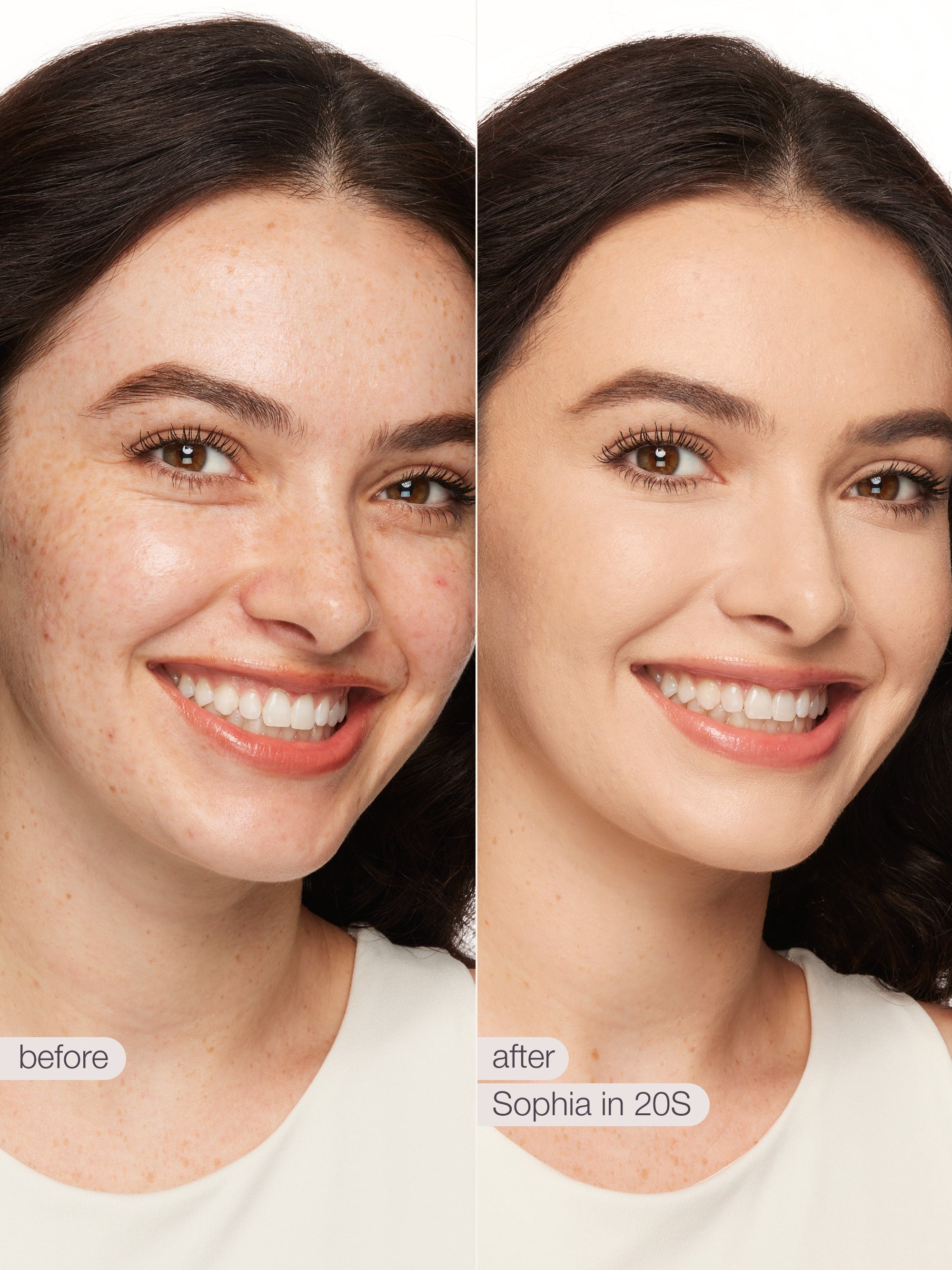 Before and after comparison of a woman's face with visible skin improvement using a product named 'Sophia in 20S'.