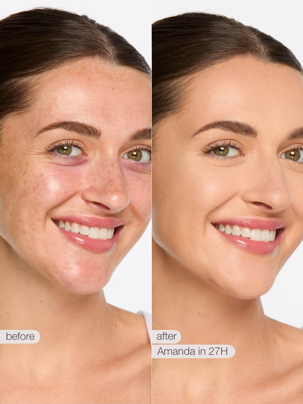 Before and after comparison of a woman's face with text indicating time elapsed.