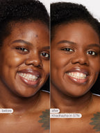 Before and after comparison of a woman's face with Knadadhza in 57N application.