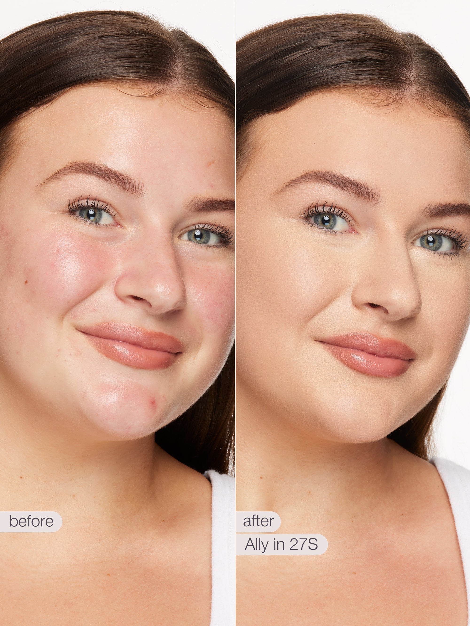 Before and after comparison of a woman's face with visible skin improvement using a product labeled 'Ally in 27S'.
