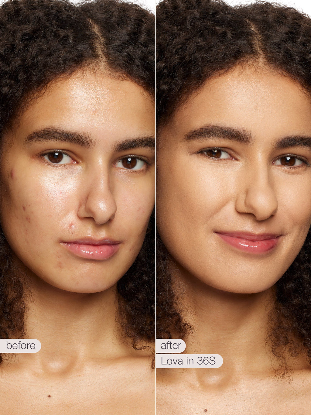 Before and after comparison of a woman's face with Lova skincare product application.