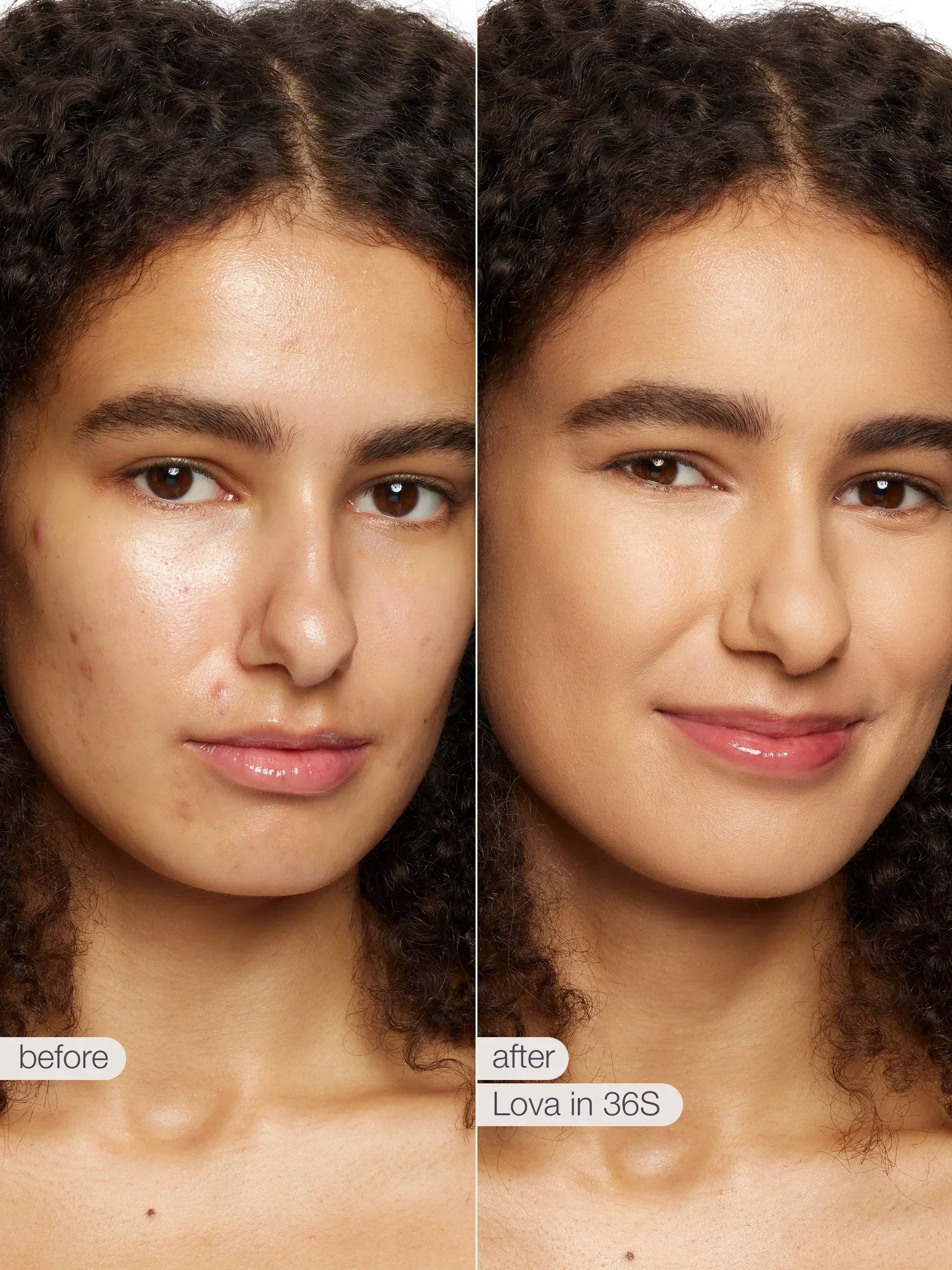 Before and after comparison of a woman's face with Lova skincare product application.