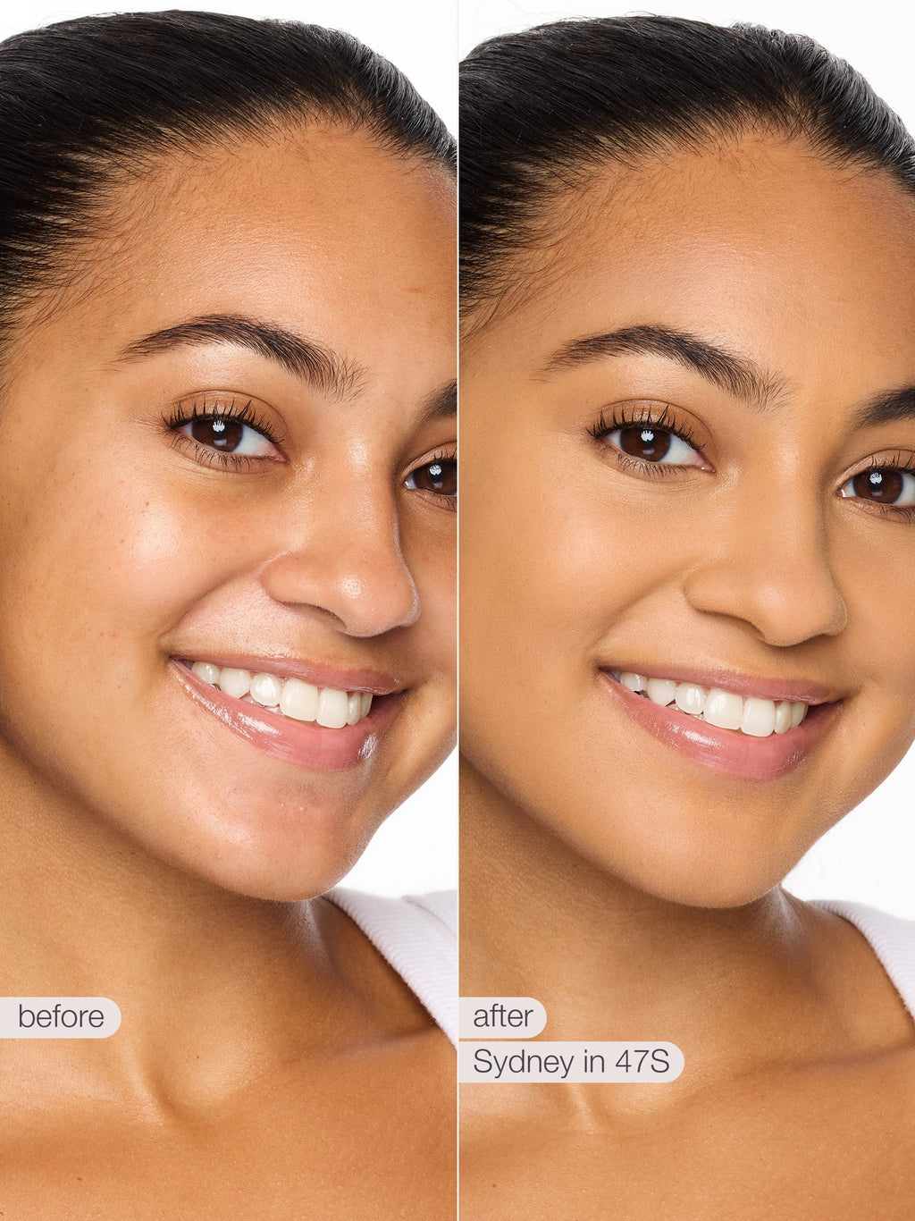 Before and after comparison of a woman's face with text indicating a product or treatment name.