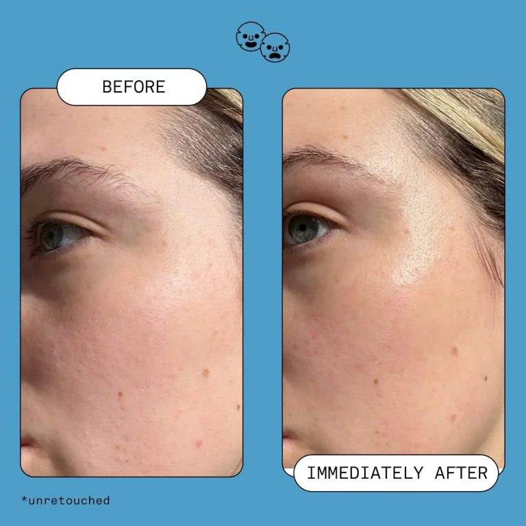 Omega Rich Moisturizer