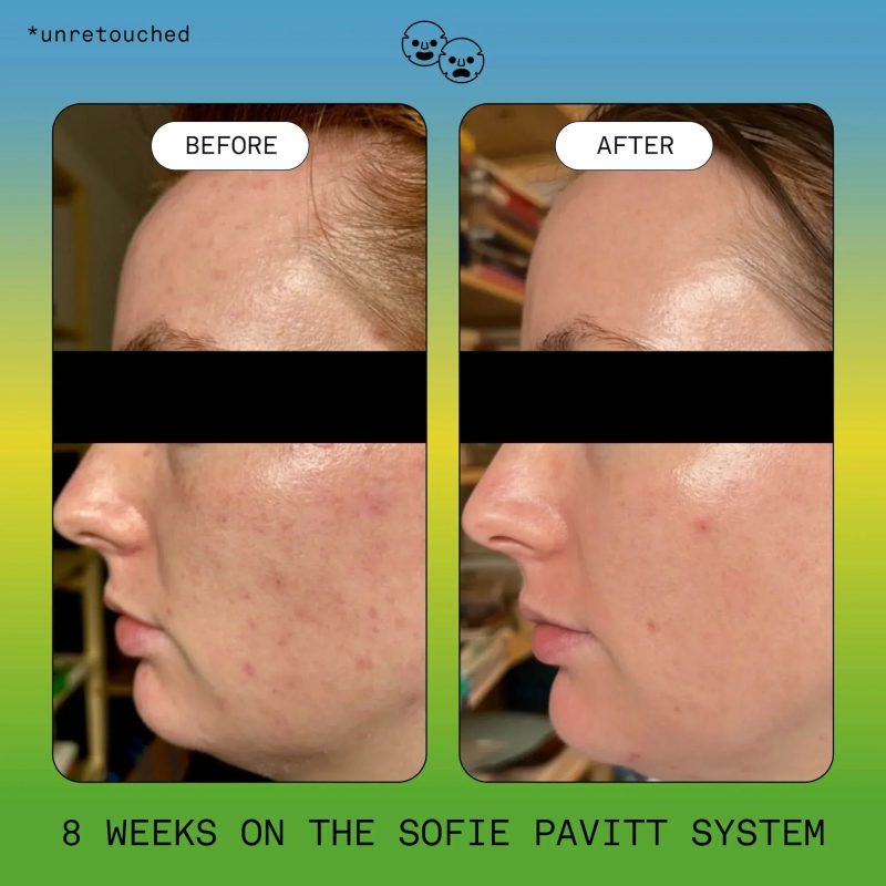 Sofie Pavitt Skin School Trial Set: The System Minis