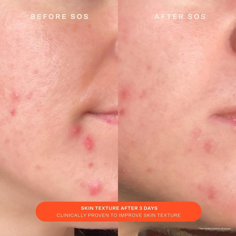 Tower 28 SOS Recovery Cream